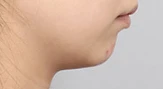 before_image