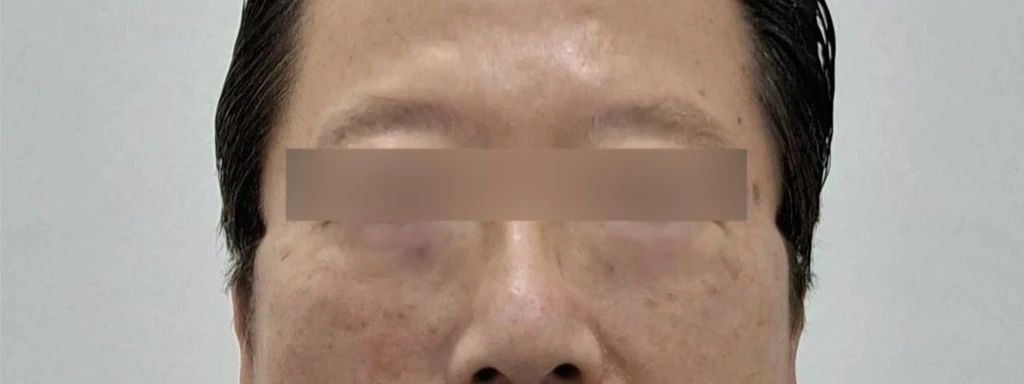 before_image