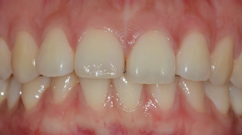 before_image