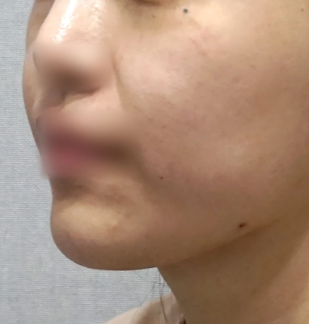 before_image