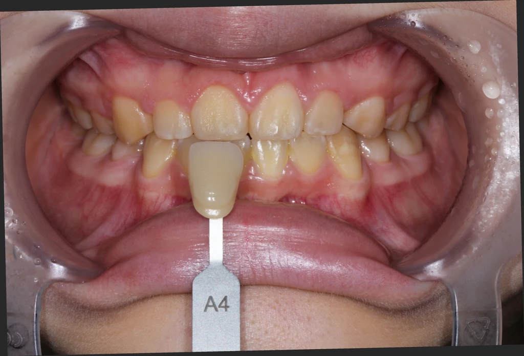 before_image