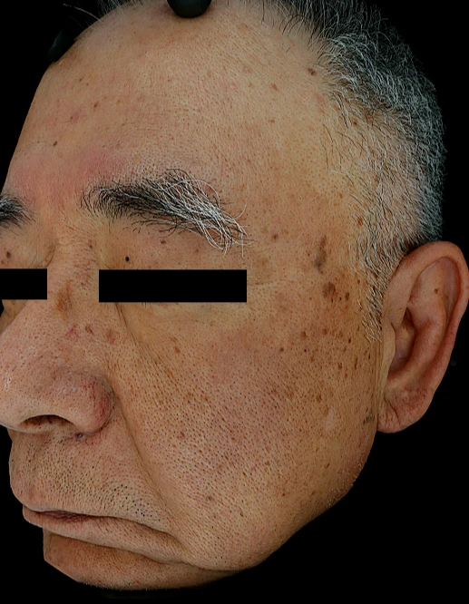before_image