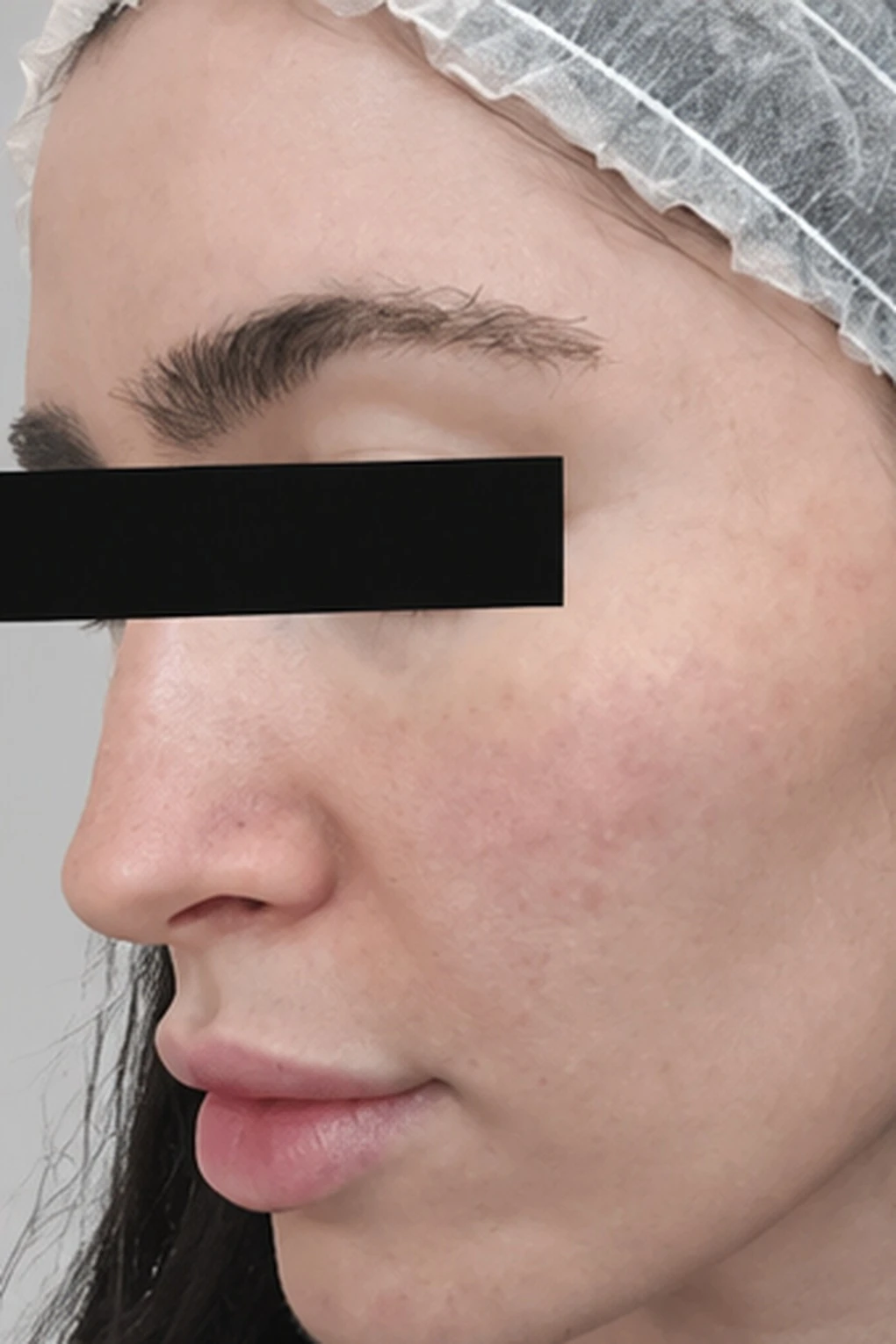 before_image