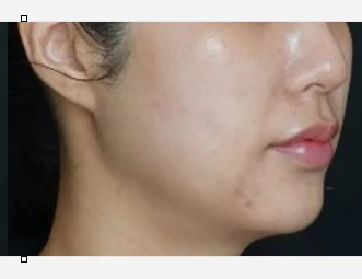 before_image