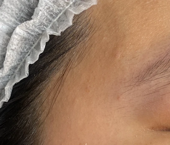 before_image