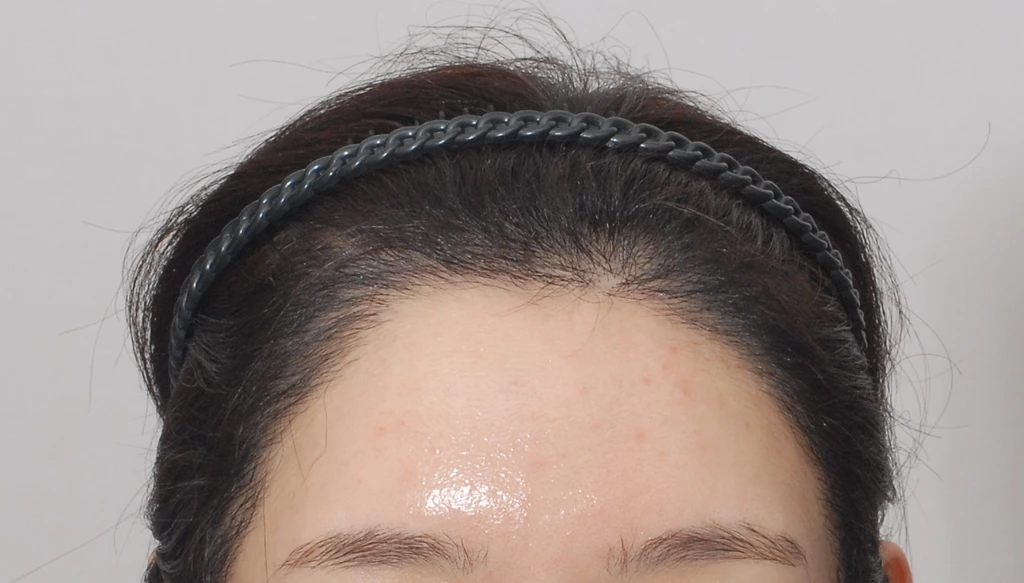 before_image