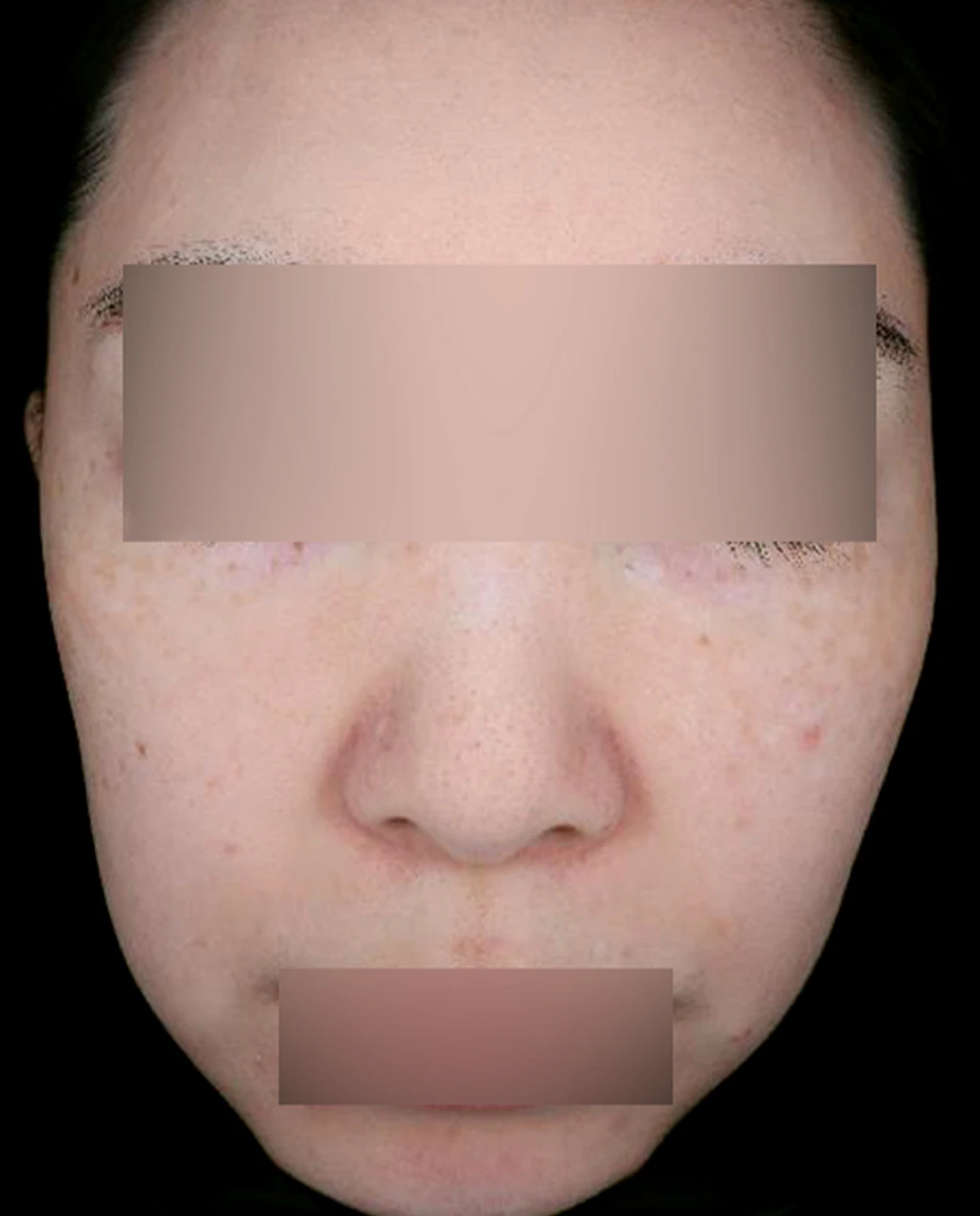 before_image