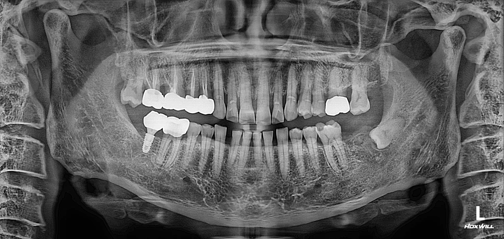 before_image