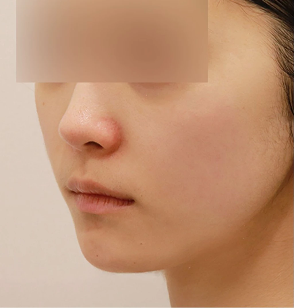 before_image