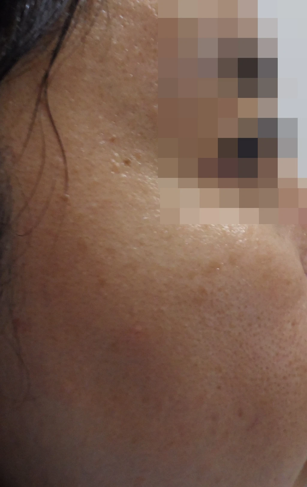 before_image