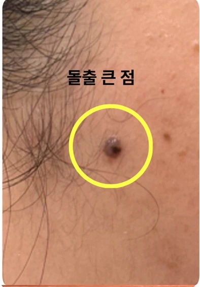 before_image