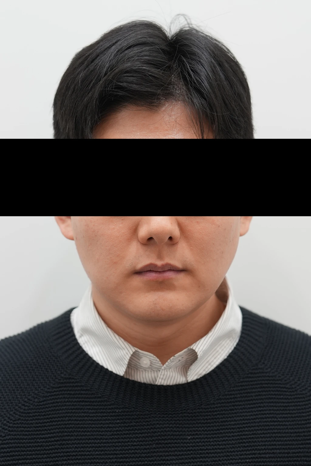 before_image