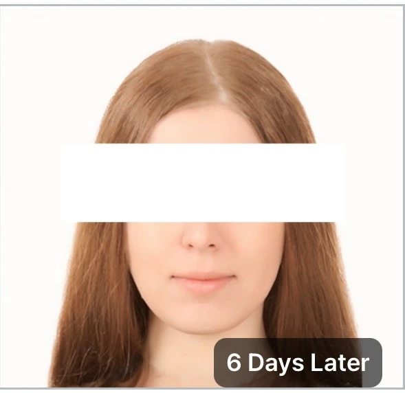 before_image