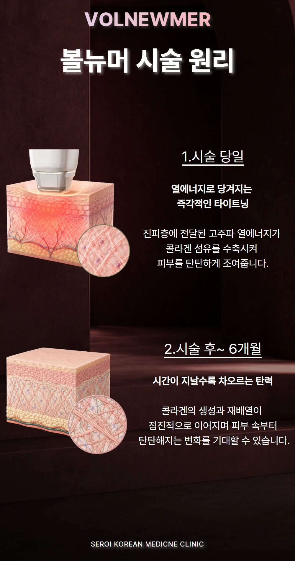 treatmentIntroduction