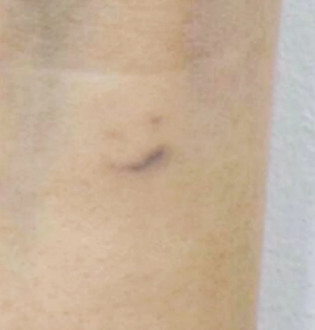 before_image