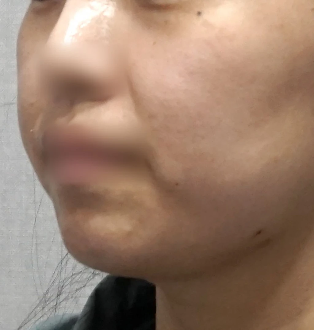 before_image