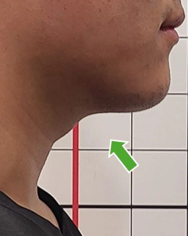 before_image
