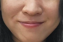 before_image