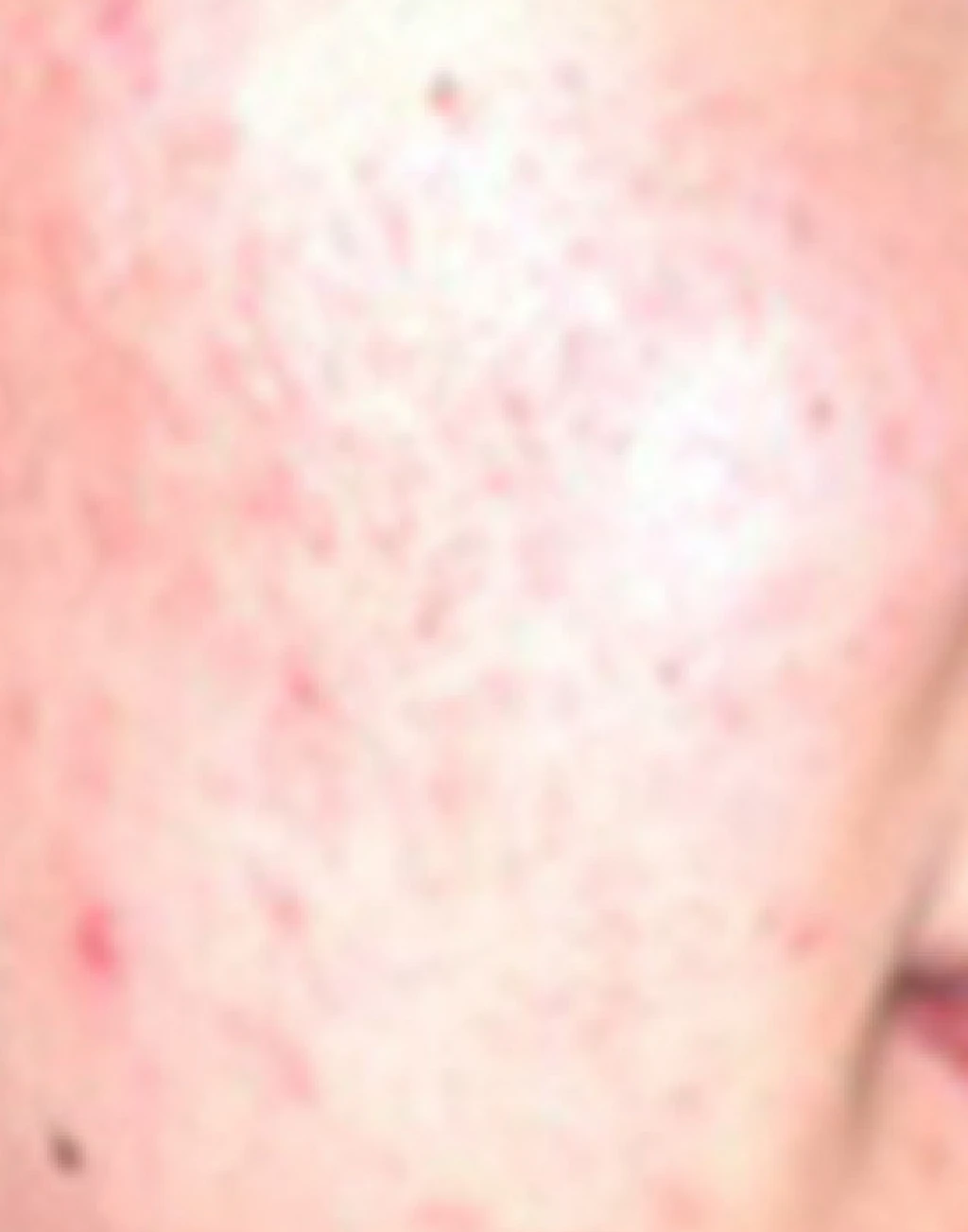 before_image