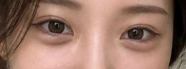 before_image