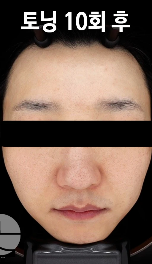 before_image