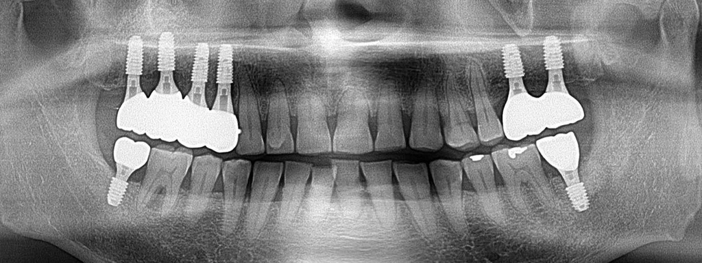 before_image