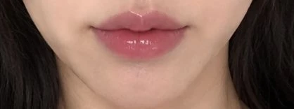before_image