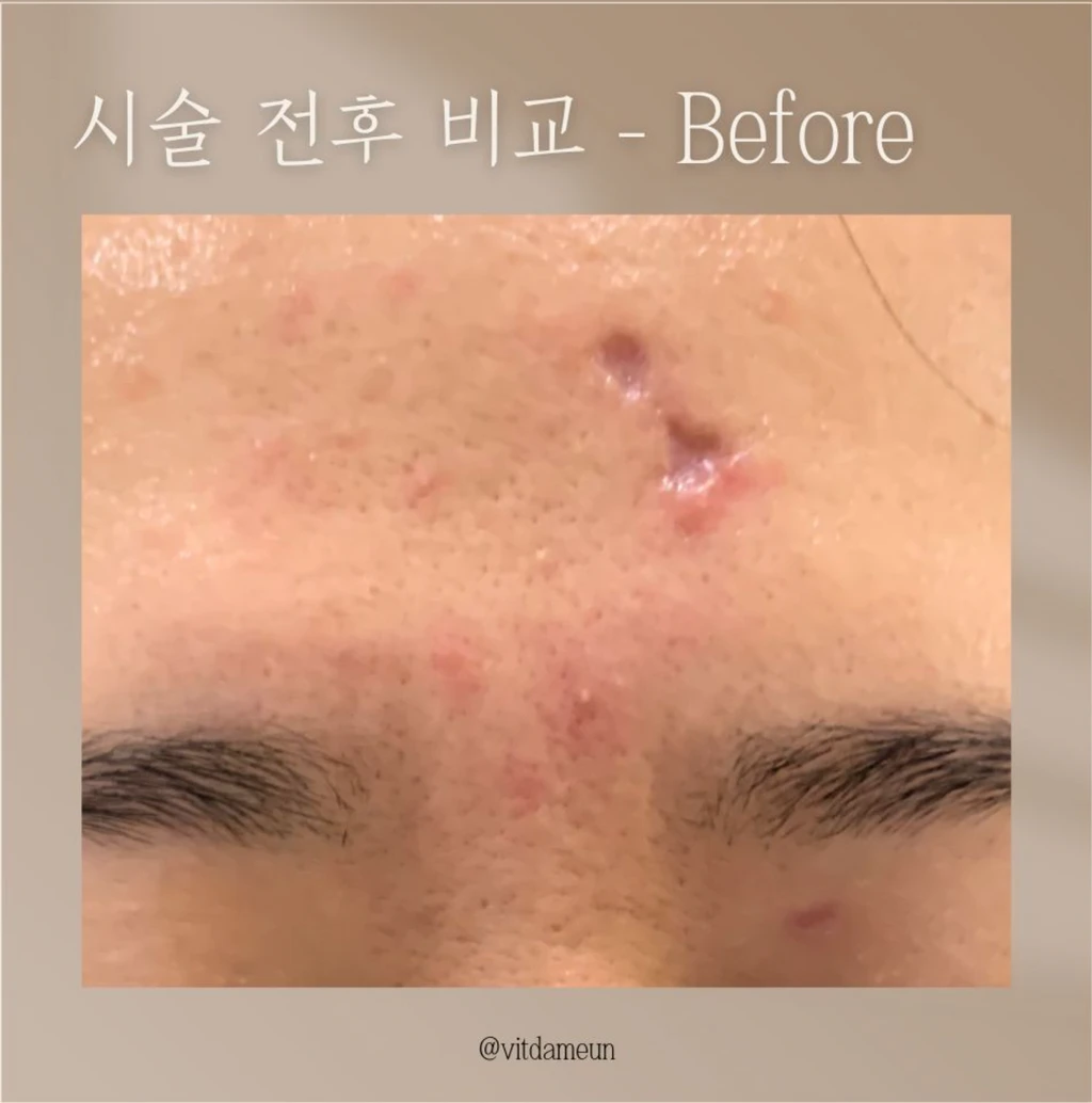 before_image