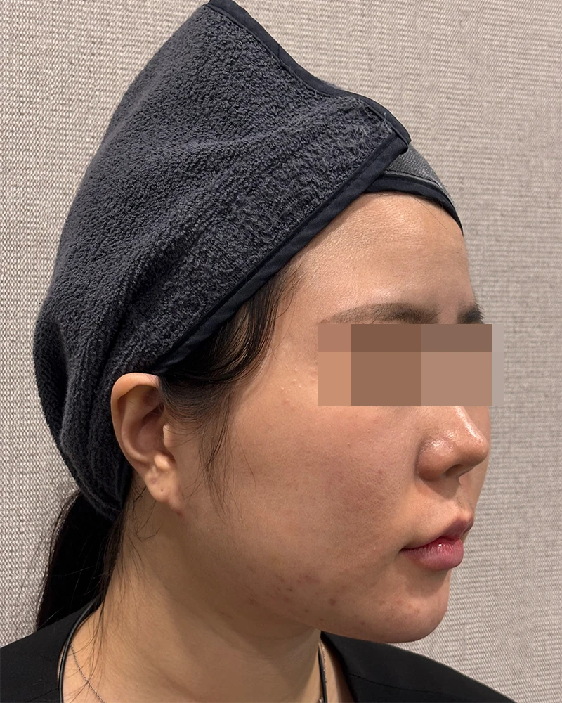 before_image
