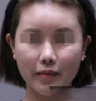 before_image