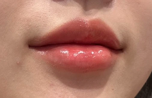 before_image
