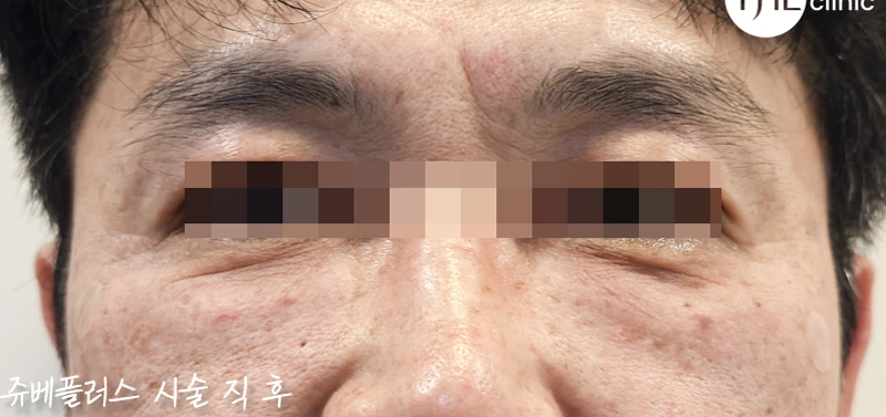 before_image