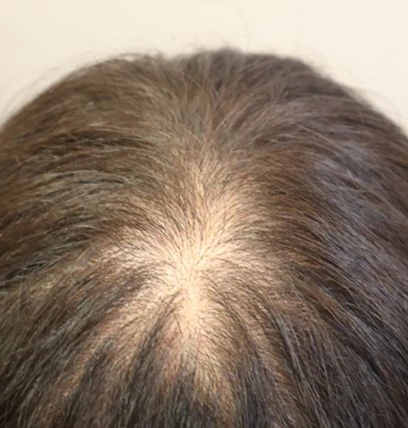 before_image