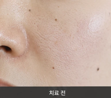 before_image