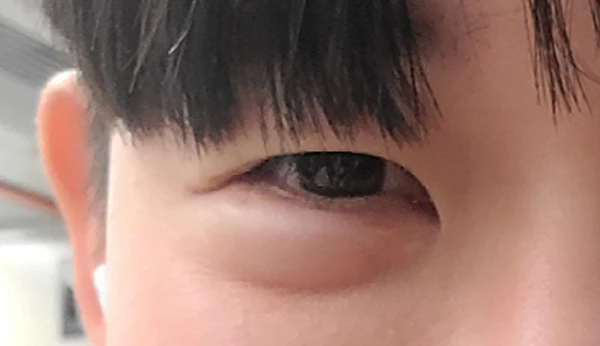 before_image