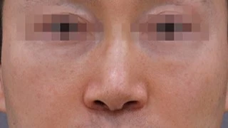 before_image