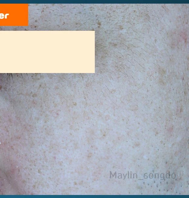 before_image