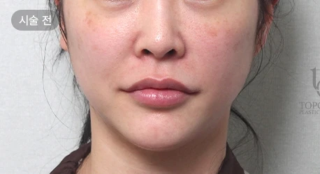 before_image