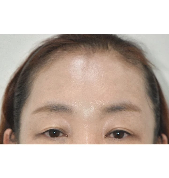 before_image
