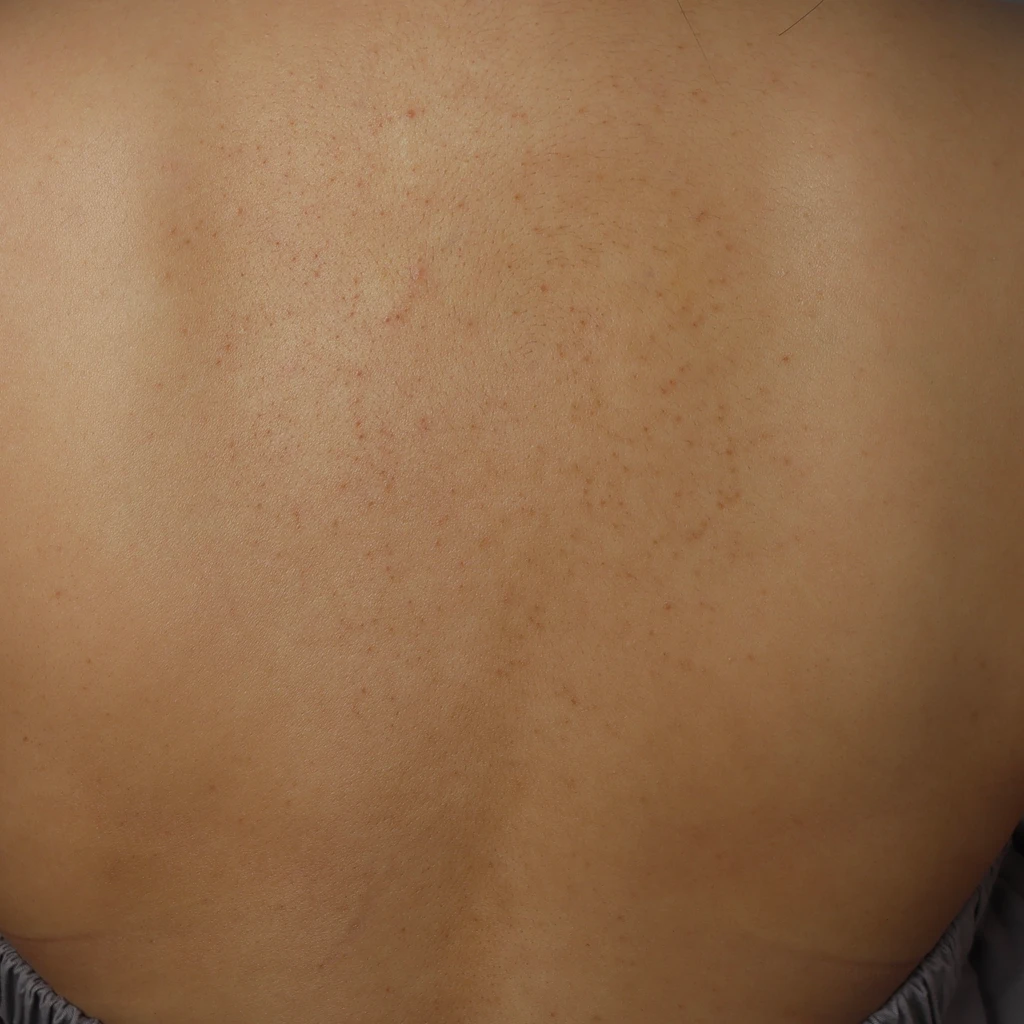 before_image