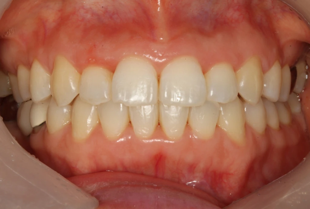 before_image