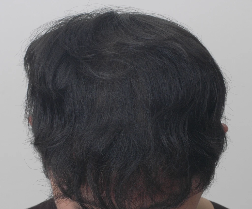before_image