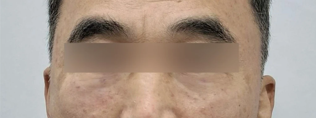 before_image