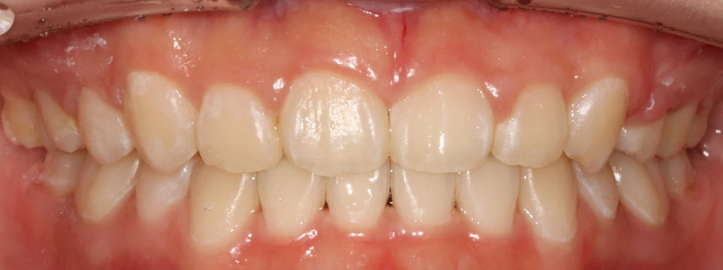 before_image