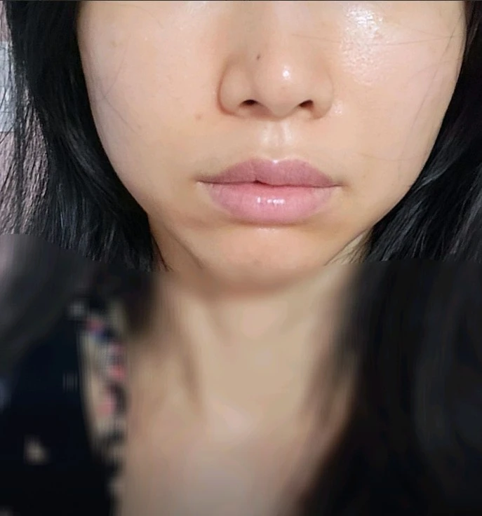 before_image