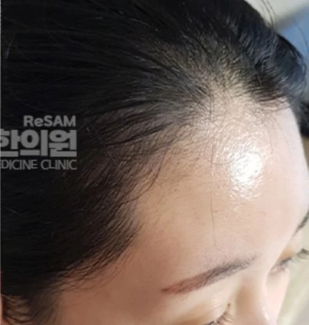 before_image