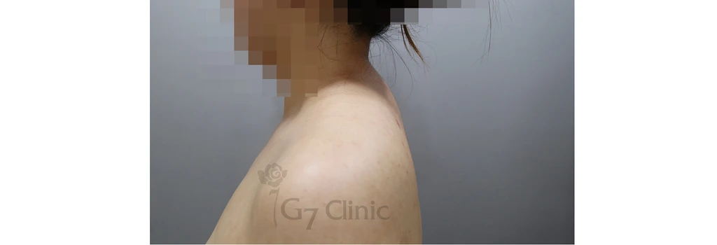 before_image