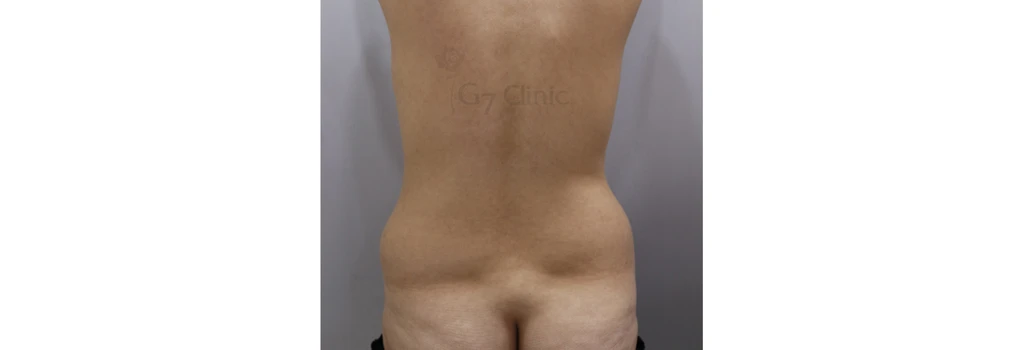 before_image