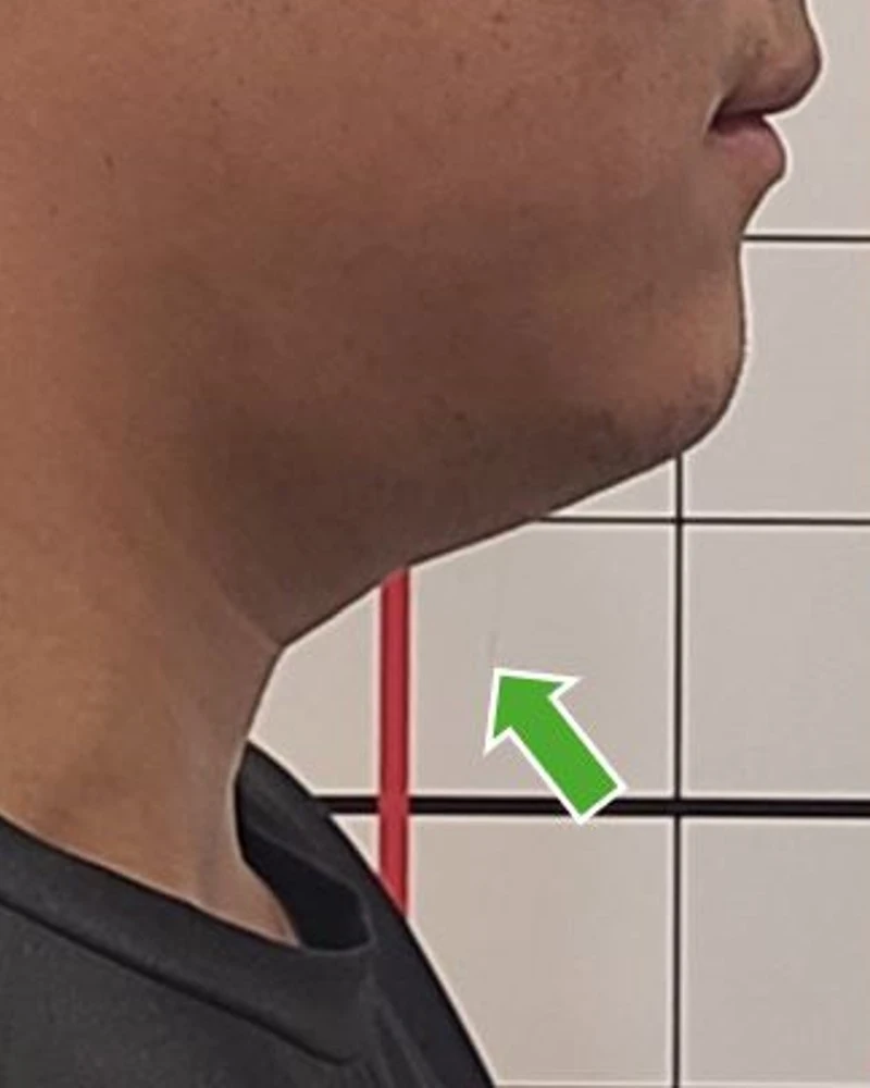 before_image