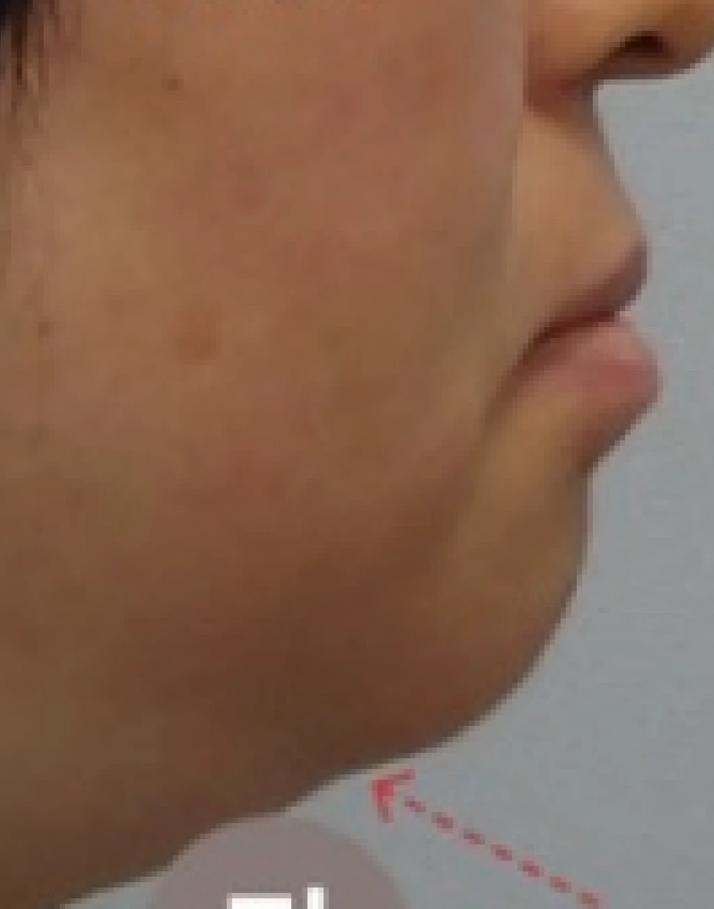 before_image